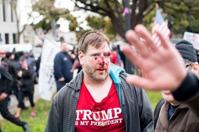 violence-at-berkeley-rally-for-trump-3